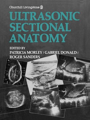 cover image of Ultrasonic Sectional Anatomy